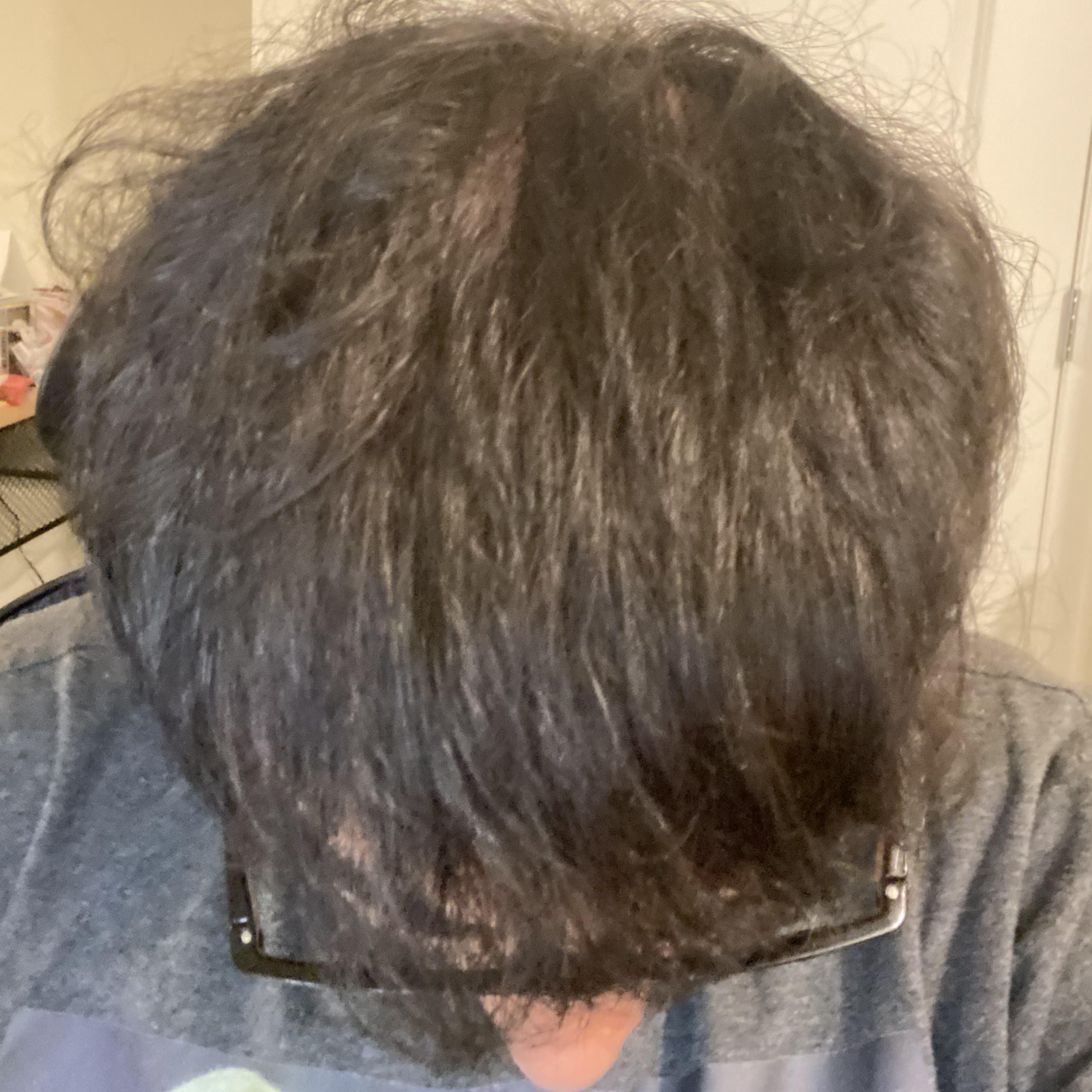 overhead photo of client after